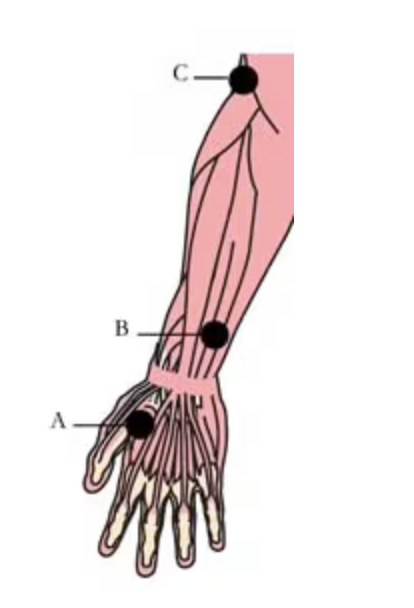 protizánětlivé body
